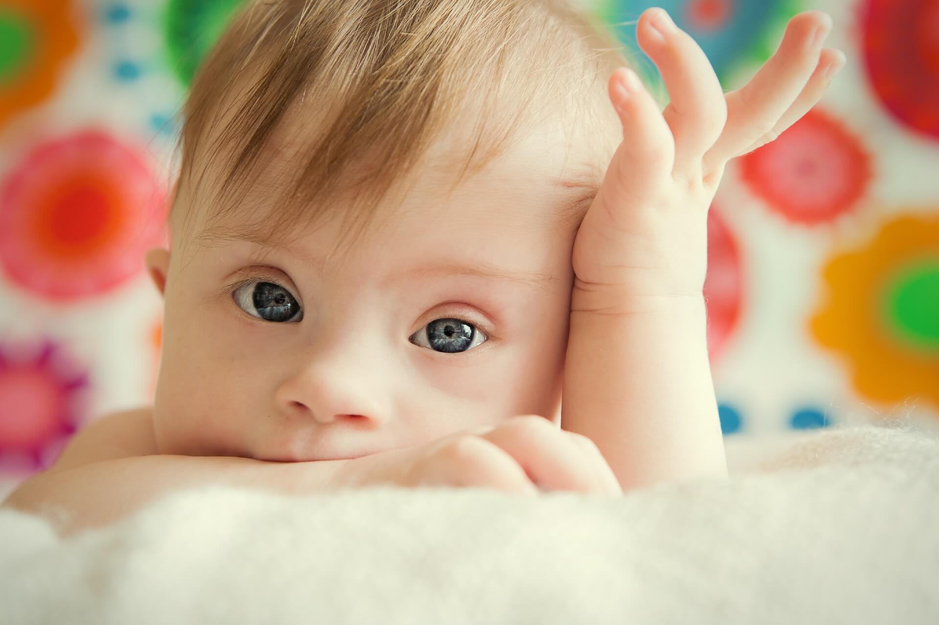 hipotonia infantil: bebês com síndrome de down