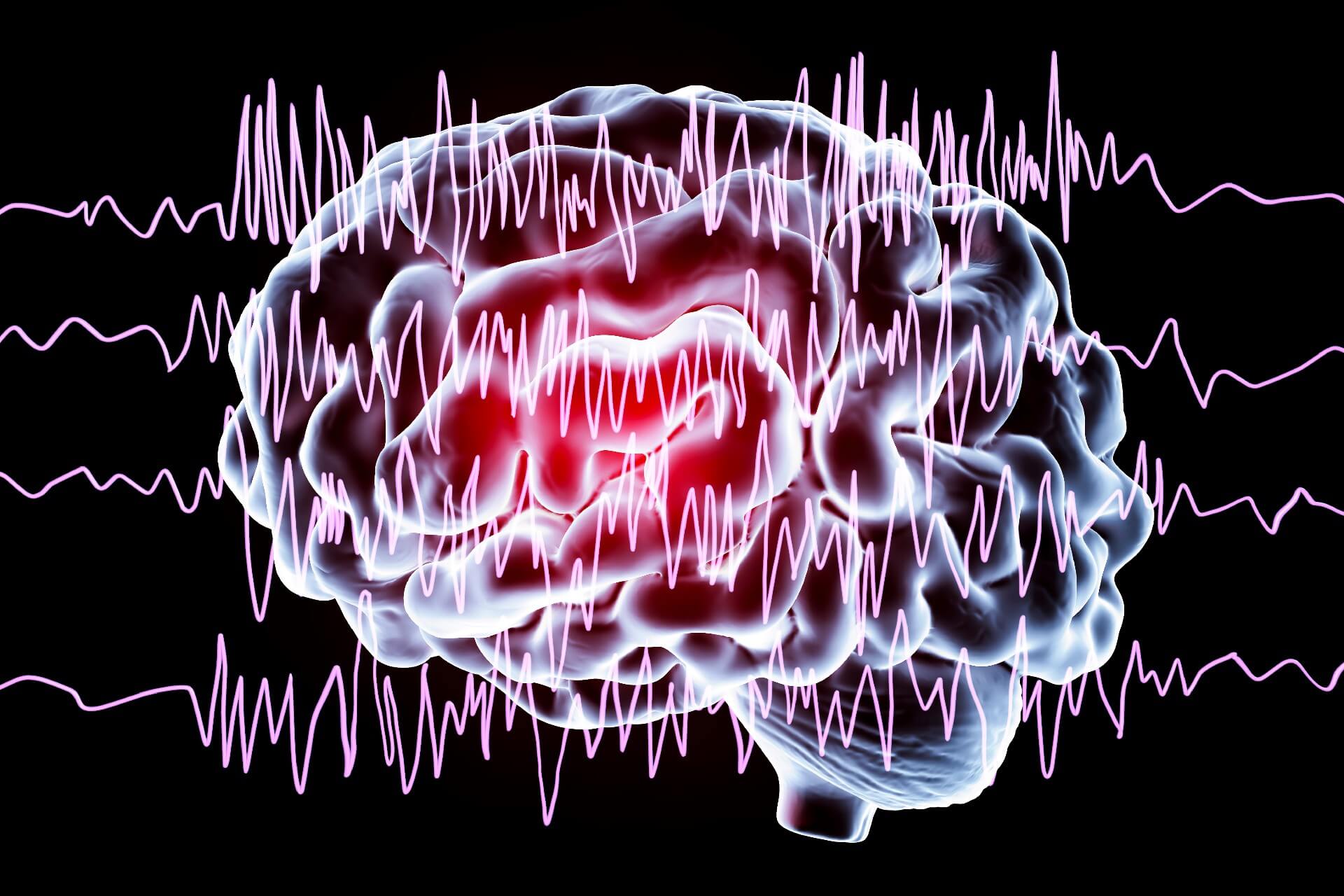 epilepsia: funcionamento do cérebro
