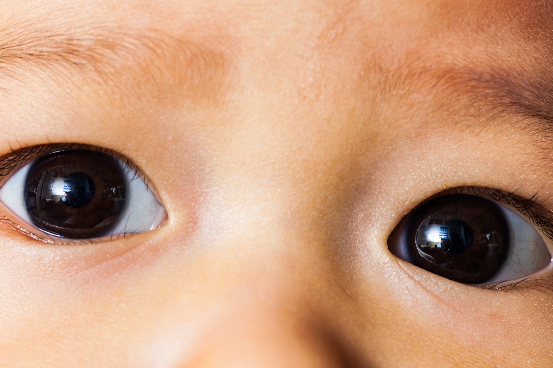 triagem neonatal - triagem ocular